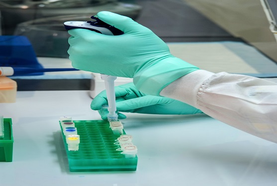 protein-purification